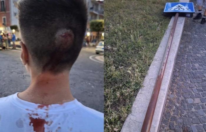 Pozzuoli choc, ferito alla testa da un palo stradale mentre passeggiava in via Napoli – .