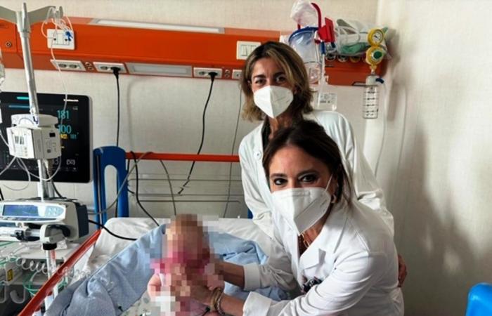 Messina, neonato di 27 giorni curato per atrofia muscolare spinale – .