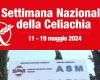 In occasione della Settimana nazionale della celiachia, iniziativa ASM a Turi a Matera – .