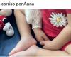 Terni. Un sorriso per Anna. Raccolta fondi su GoFundMe per aiutare la famiglia della bambina ricoverata all’ospedale di Roma – .